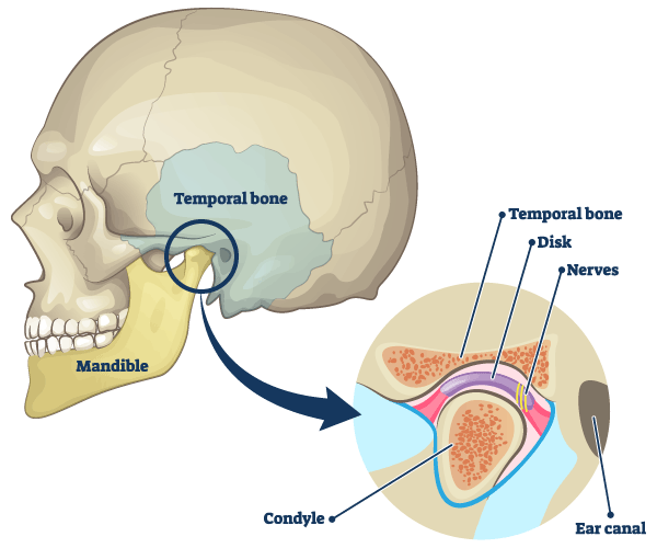 temporomandibular joint disc